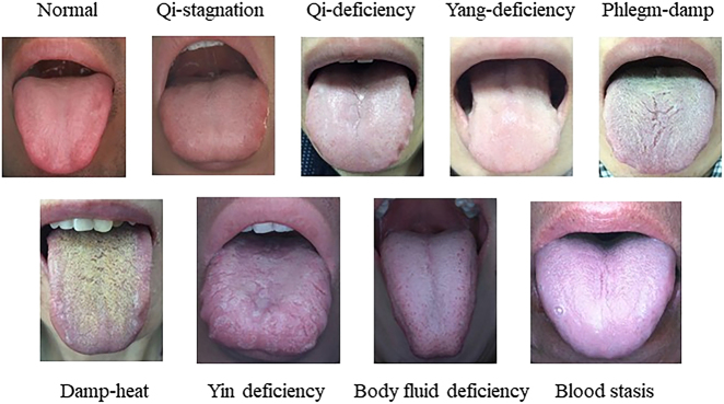 Nine representative tongue images labeled by TCM constitution category