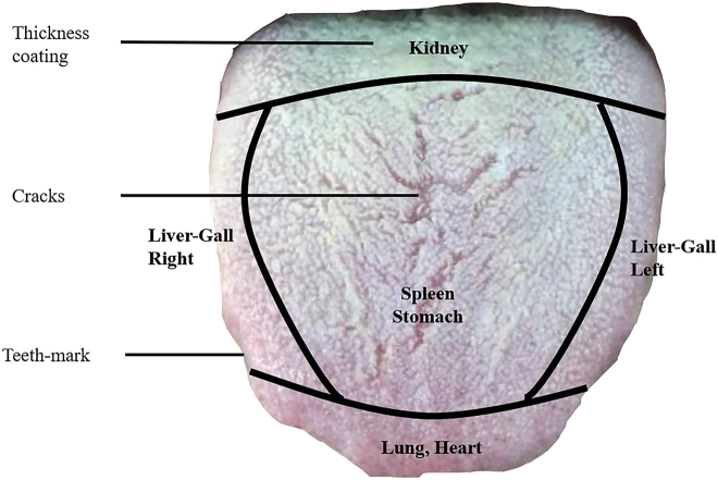 Traditional tongue-region correspondence diagram with coating, cracks, tooth marks, and labeled regions